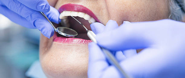 Best Emergency Cosmetic Dentistry in Rochester, IL